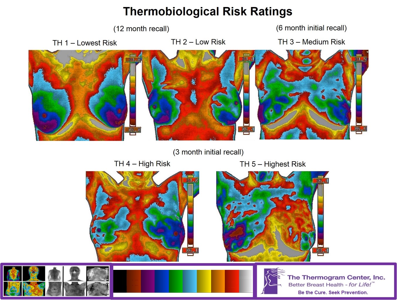 Thermo Image for breasts